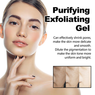 Deep Exfoliating Gel - Cherry Blossom Extract | Pore Shrinking