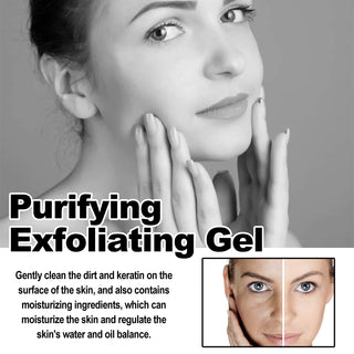 Deep Exfoliating Gel - Cherry Blossom Extract | Pore Shrinking