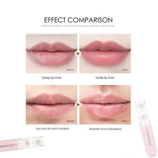Lip Care Yifeng Lip High Frequency Vibration Lip Massager